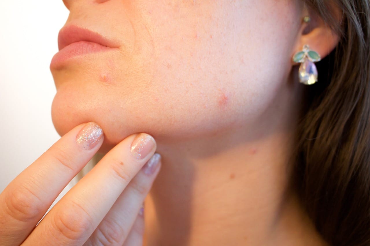 Managing Inflammatory Skin Infections