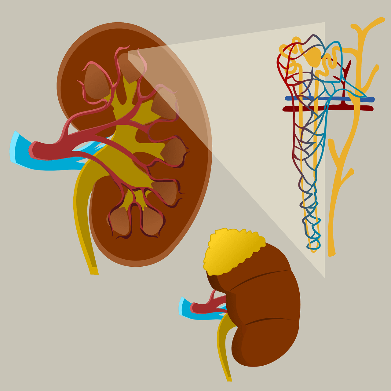 Understanding Glomerulonephritis