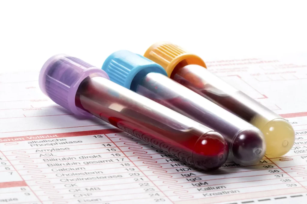 Blood Test Results as example